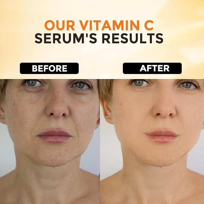 Vitamin C Serum for Face –Anti Aging Face & Eye Serum, Hyaluronic Acid, Reduce Fine Lines, Dark Spots and Wrinkle