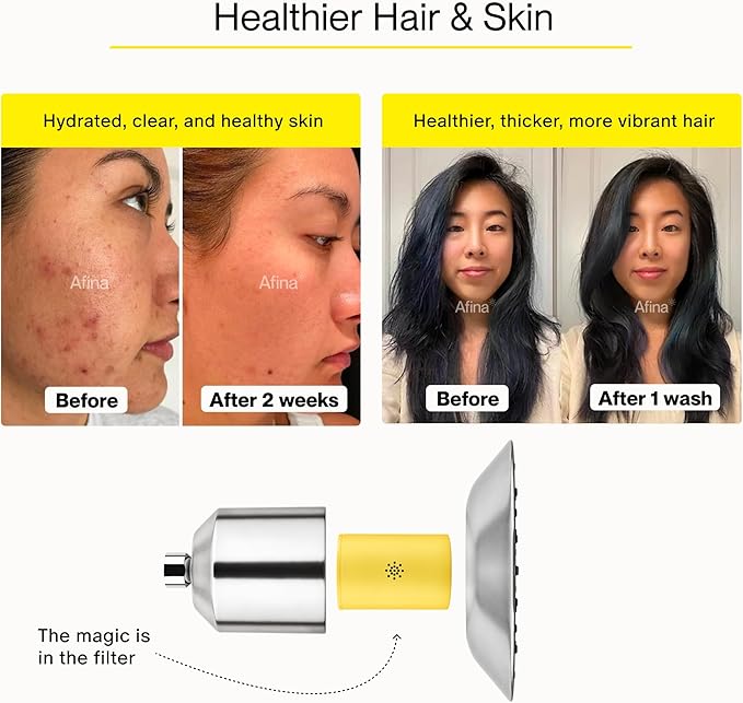 Afina Shower Filter - High Pressure Filtered Shower Head with Advanced Water Filtration - Improves Skin & Hair by Reducing Chlorine & Heavy Metals from Hard Water - Easy Installation (Black)