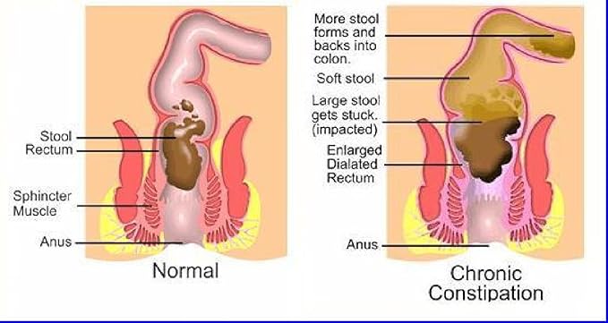 The One Minute Miracle Oxy-Colon Cleanse Vegan Colon Cleanser - 120 Vegatarian Capsules.