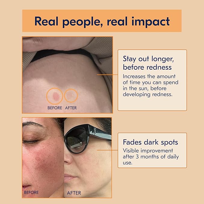 The First 3-in-1 Drinkable Skincare, by World-Class Dermatologist & Skin Surgeon, Regenerative Formula, Nicotinamide, Collagen Peptides, Biotin, Glutathione (30 Servings, Melon Sunrise)
