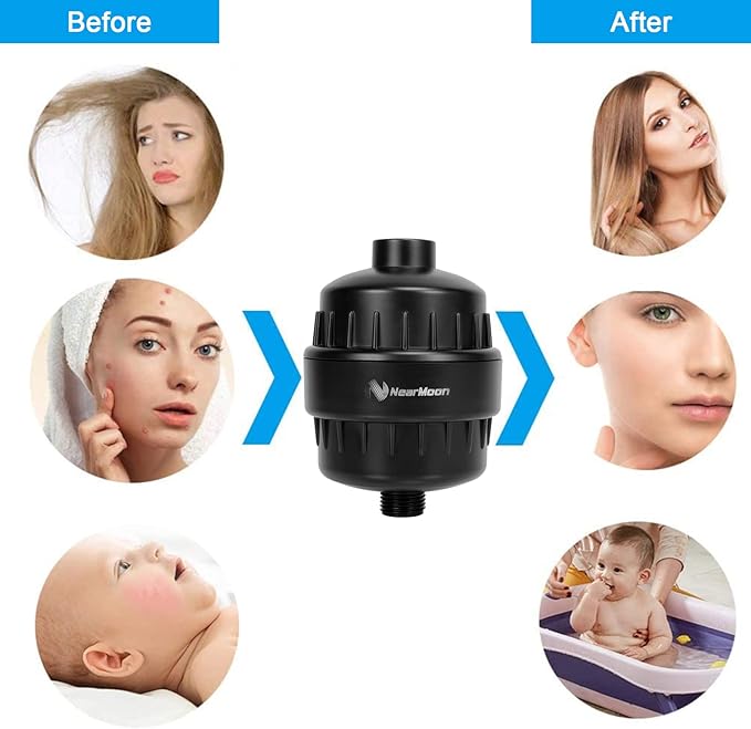NearMoon High Output 15 Stage Shower Filter - Filtered Shower head softener for Hard Water，Reduces Dry Itchy Skin, Dandruff and Improves the Condition of Your Skin, Hair (Matte Black)
