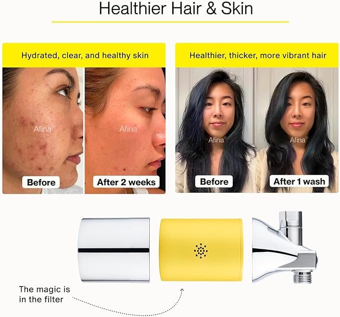 Afina Shower Head Filter - Shower Filter for Hard Water | High Pressure Shower Water Filter - Improves Skin & Hair by Removing Chlorine & Heavy Metals, Transform Your Shower Head with Filters (Black)