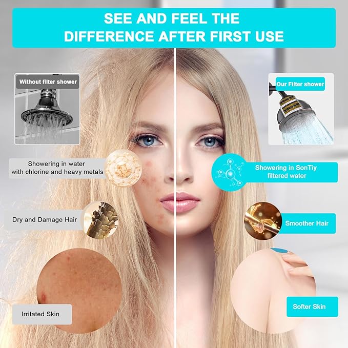 SonTiy Filtered Shower Head, All Metal Shower Filter Head For Hard Water Removes Chlorine, Improve Hair Skin, Adjustable High Pressure Water Softener Showerhead, 6 Inch, Oil Rubbed Bronze