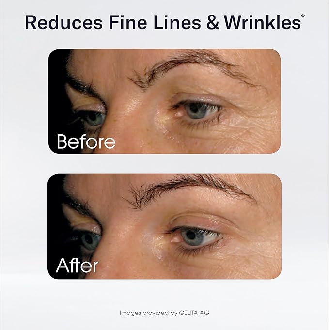 Sparkle Wellness Skin Boost Collagen Capsules (180 Pills) | 30 Days of 2500mg VERISOL Collagen Peptides & Vitamin C | Improves Skin Elasticity & Appearance of Fine Lines | Strengthens Hair & Nails
