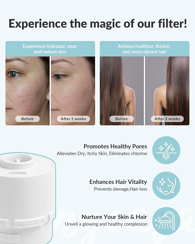 Filtered Shower Head for Hard Water, Removes Chlorine, KDF-55 Filter Dermatologist Recommended for Softening Hard Water (BNP)