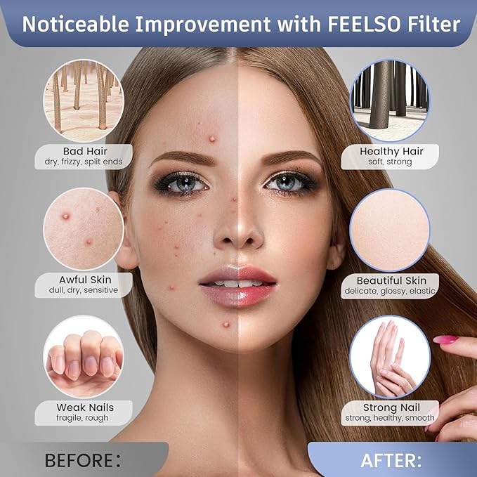 FEELSO Filtered Shower Head with LED Color Changing, 7 Modes High Pressure Rain Shower Head with Filters, Water Softener Showerhead for Hard Water Remove Chlorine, Reduces Dry Itchy Skin & Hair