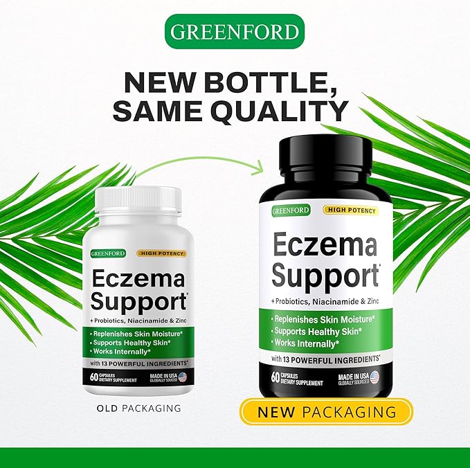Greenford Eczema Treatment & Support for Natural Relief - Made in USA - Skin Vitamins & Herbals for Eczema, Acne, Psoriasis, Rosacea Treatment with Zinc, Niacinamide & Probiotics - 60 caps
