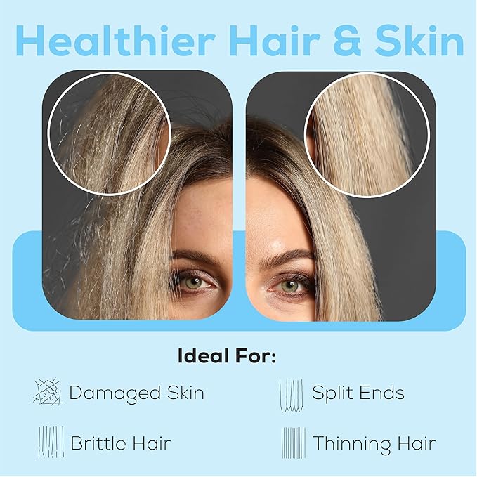 SparkPod 23 Stage Shower Head Filter for Dry Hair and Skin - High Output Universal Shower Filters to Remove Toxic Chemicals, Chlorine & Heavy Metals (Elegant Brushed Nickel)