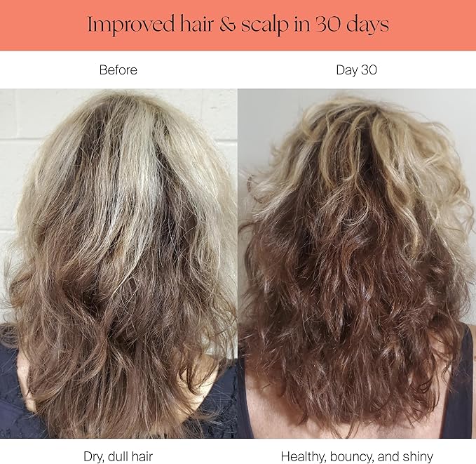 Canopy Filtered Shower Head - High Pressure Shower Head Filter for Hard Water - Shower Filter To Remove Impurities for Healthier Scalp, Skin & Hair - Reduce Dry Skin & Breakage - Black Shower Head